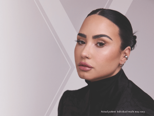 Demi Lovato with Xeomin X - Actual patient. Individual results may vary.