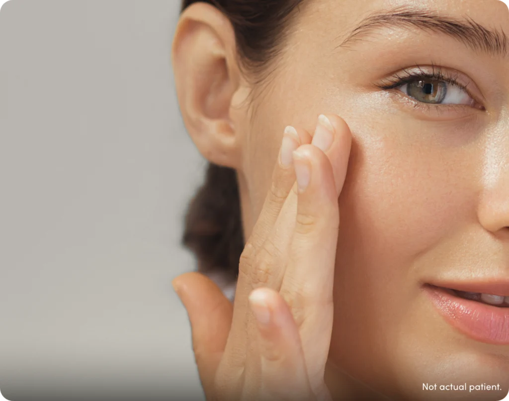 Woman touching her face with text 'not actual patient'