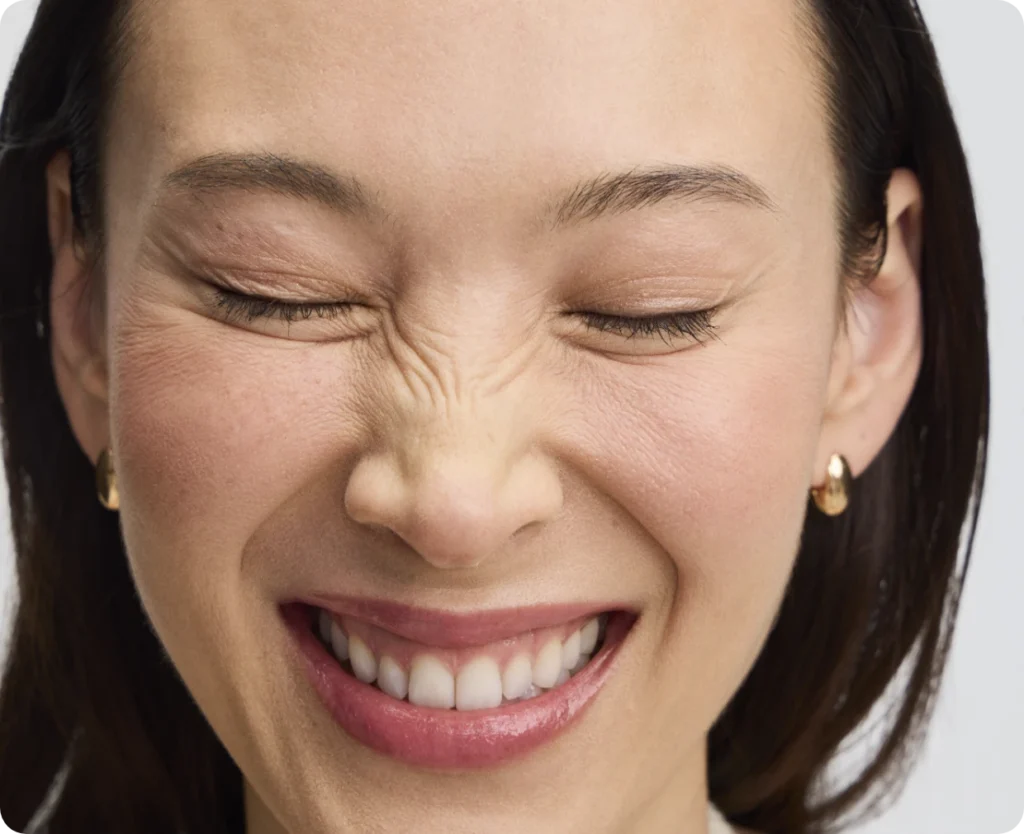 Woman smiling and scrunching her face, with smooth forehead, frown lines, and crow's feet.