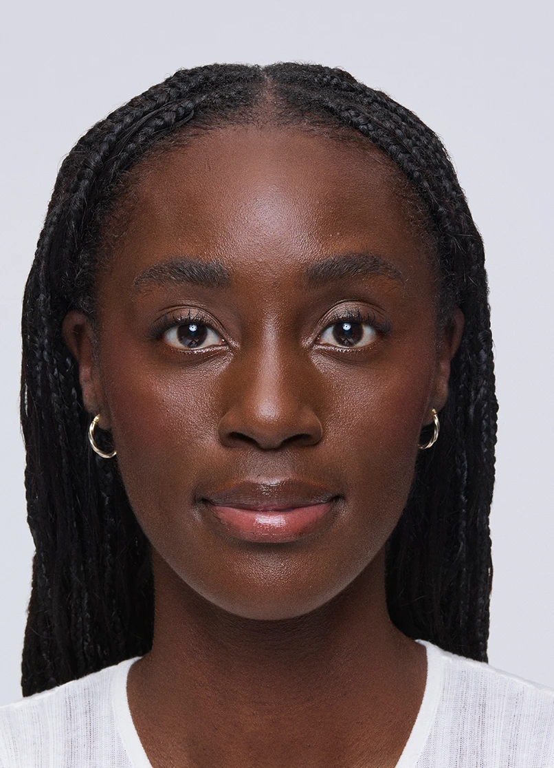 Patient Aleka raising her eyebrows with a smooth forehead.