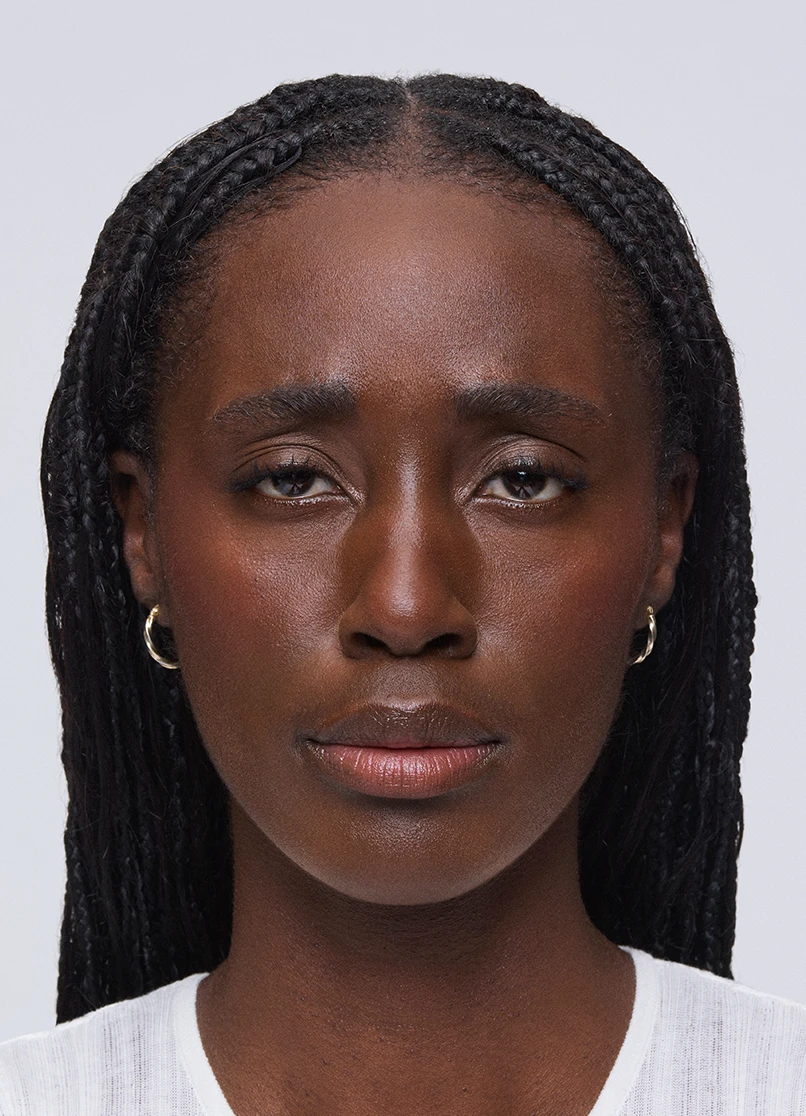 Patient Aleka frowning with no lines near her eyebrows.