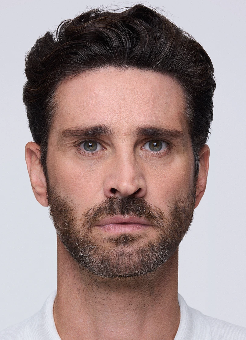 Patient Marco frowning with no lines near her eyebrows.