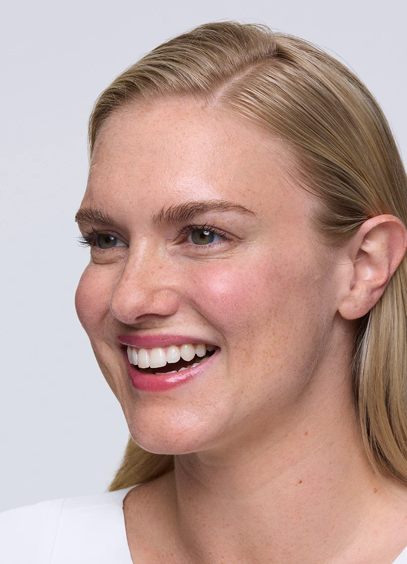 Patient Melinda smiling with no lines outside her eyes.