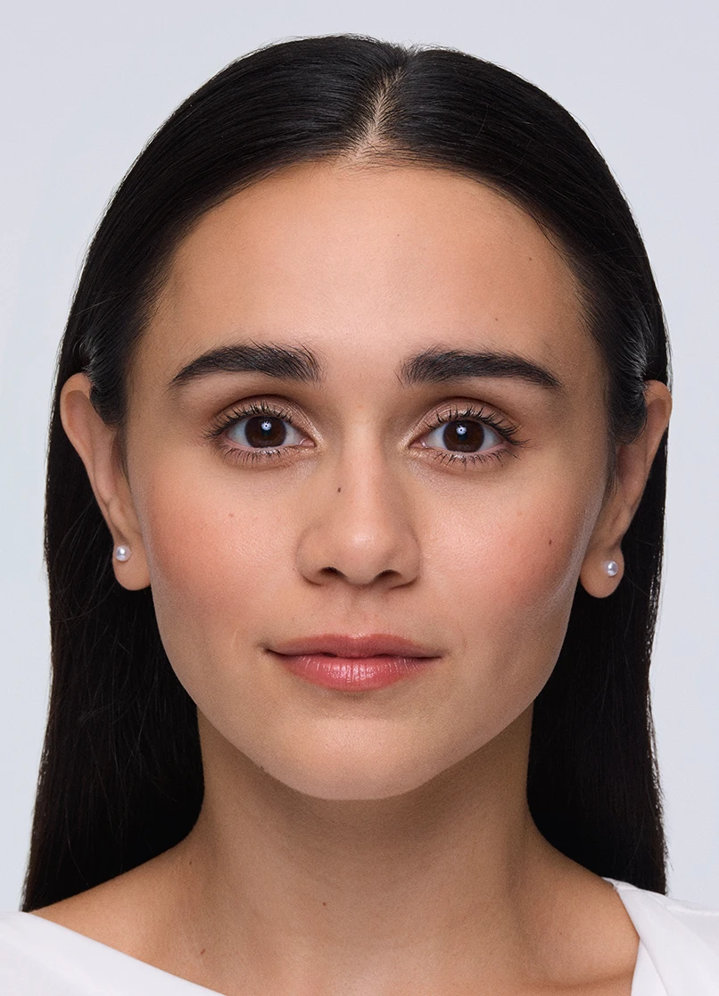 Patient Priscilla raising her eyebrows with a smooth forehead.