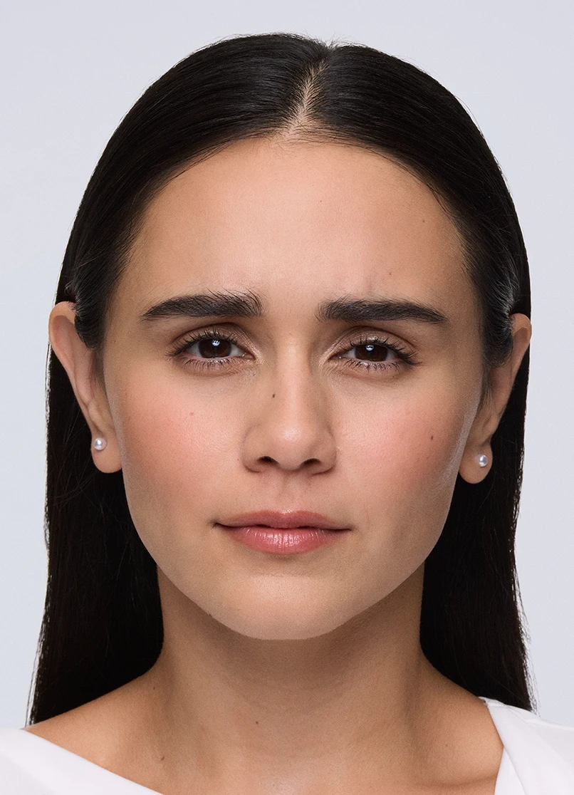 Patient Priscilla frowning with no lines near her eyebrows.