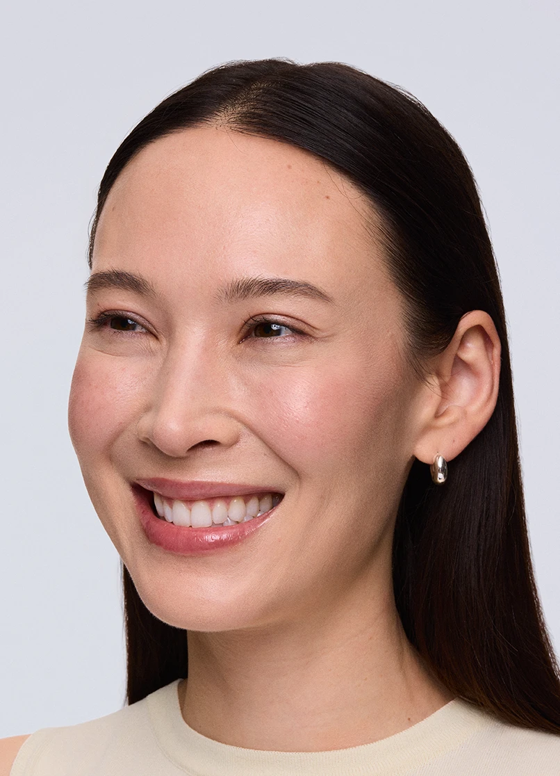 Patient Rebecca smiling with no lines outside her eyes.