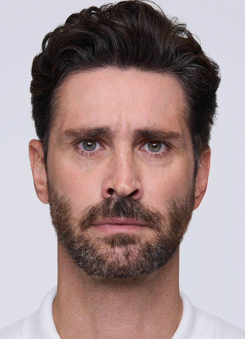 Patient Marco frowning with lines near her eyebrows.