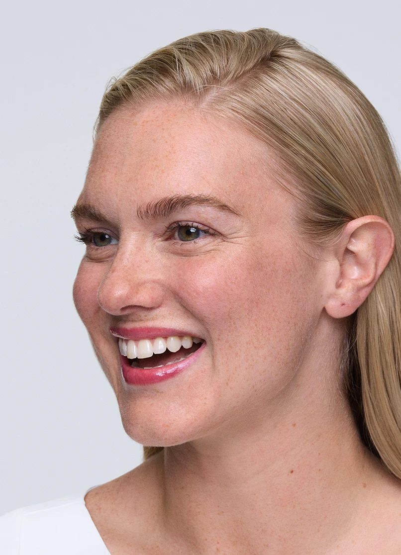 Patient Melinda smiling with lines outside her eyes.