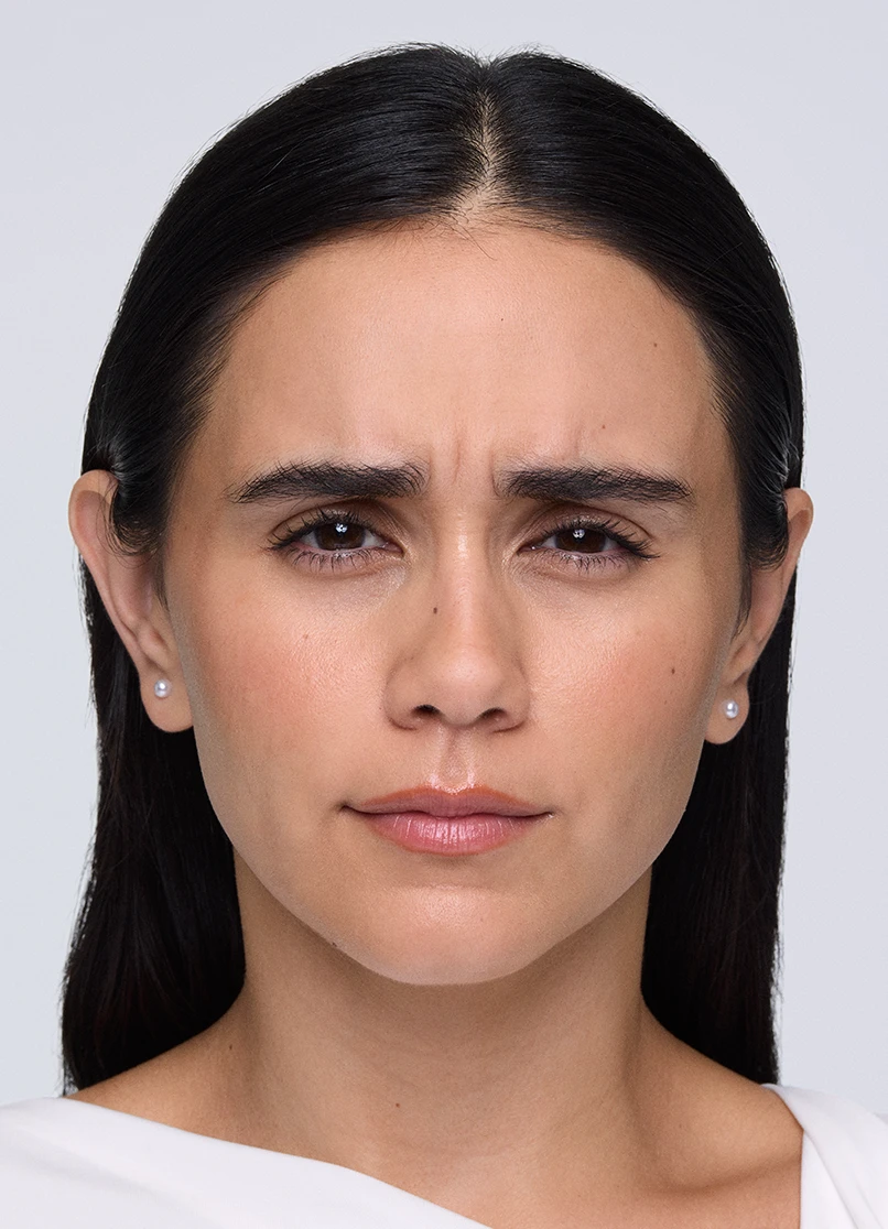 Patient Priscilla frowning with lines near her eyebrows.