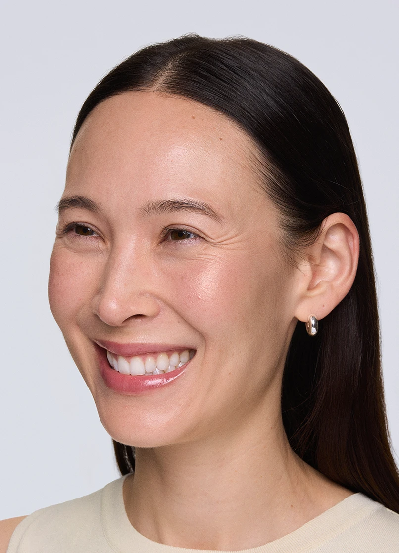 Patient Rebecca smiling with lines outside her eyes.